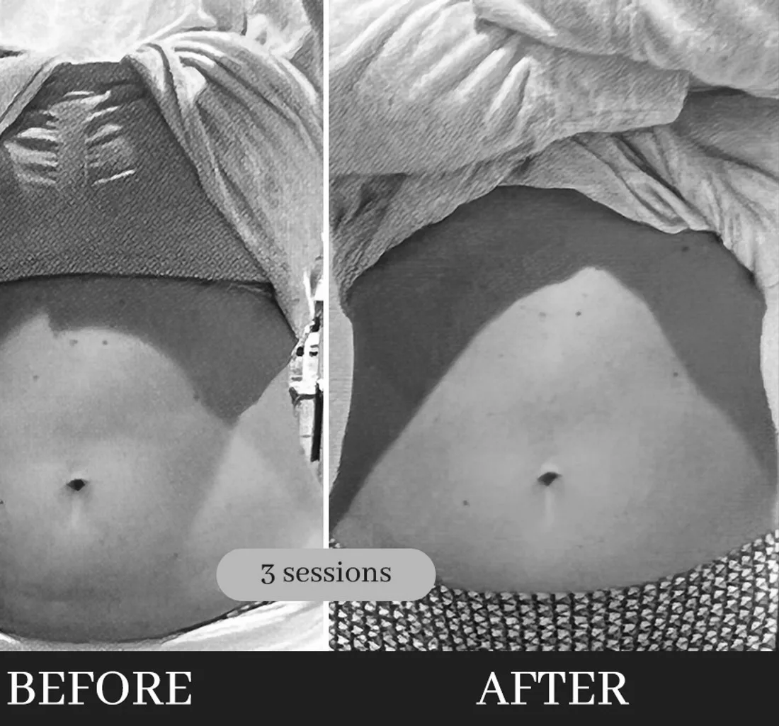 Real Results — Cryo360 2