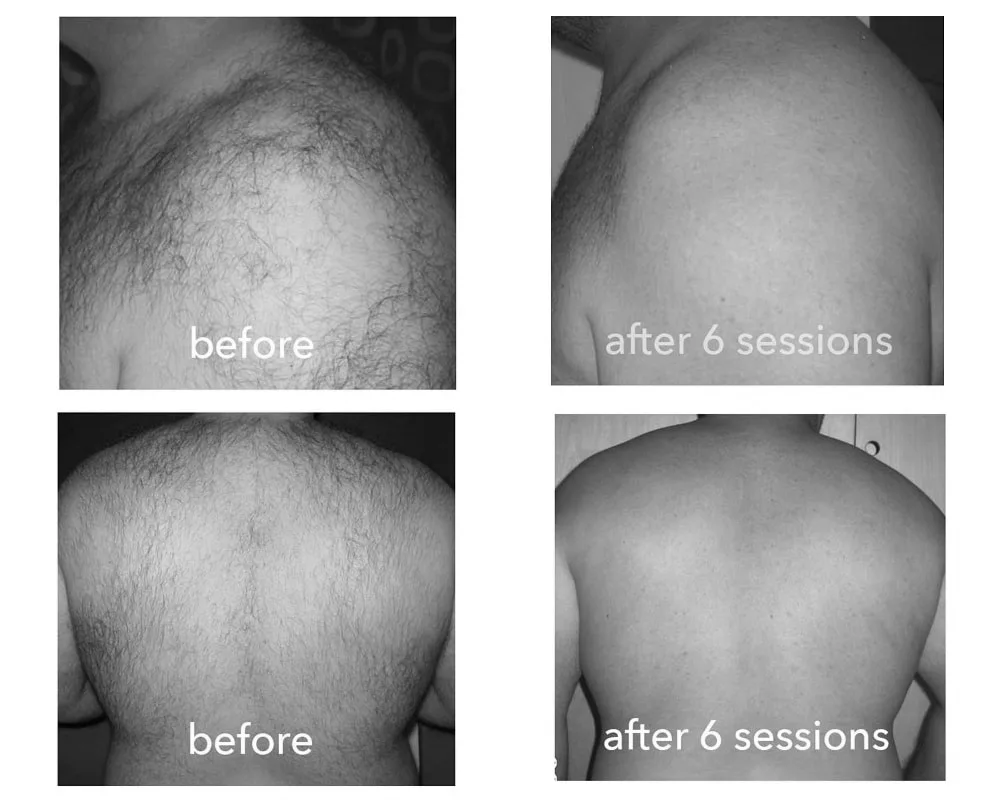 Real Results — Cryo360 3