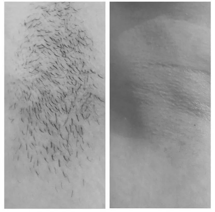 Real Results — Cryo360 4