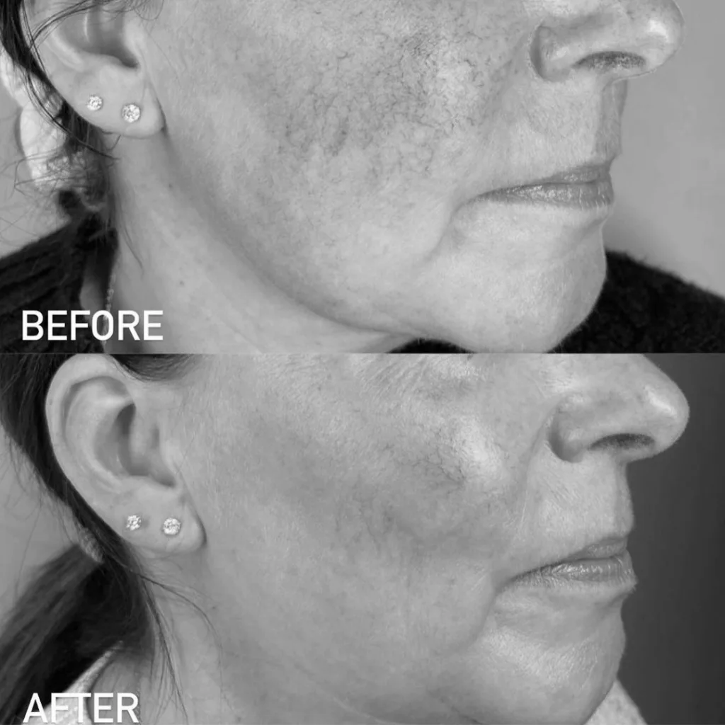 Real Results — Cryo360 5